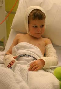 Recovering: Little Jordan Wisby suffered horrific injuries from the